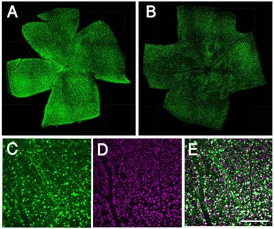 Different Effect of Sox11 in Retinal Ganglion Cells Survival and Axon Regeneration